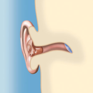 in the ear hearing aid